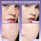 🔥 Sonderpreis des Tages nur 8,99 € Mit KOSTENLOSER BÜRSTE!!!🎁Weiche Matte Creme Concealer